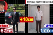 身長167cmだった男性、500万円で10cm伸ばす手術して人生変わる「太もも、スネの骨を人工的に一回折って…」 驚きの手法を公開