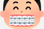 なんJ 歯列矯正するか何年も迷ってる部