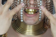 メキシコのラッパーさん、頭に金のチェーンを手術で埋め込んでしまう