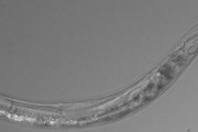 ヒトの致死量の500倍のヒ素に耐え3つの性別を持つ線虫が発見される