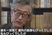 歯医者「麻酔かけますね」  両親「様子がおかしい」  歯医者「子供にはよくあること」→ 2歳女児死亡