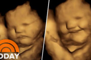 お腹の中で笑顔…母親の食べ物によって胎児の表情が変化…中絶議論にも一石投じる[海外の反応]