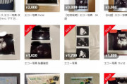 【悲報】メルカリ、「胎児のエコー写真」が売られていることが判明ｗｗｗｗｗｗｗｗｗｗ