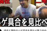 【悲報】人気youtuberのゆゆうたさん、ガチでめちゃくちゃハゲていた