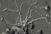 【イタリア】2000年前の噴火で死亡した遺体、頭蓋骨から無傷の脳細胞を発見