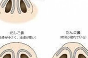 鼻の整形について