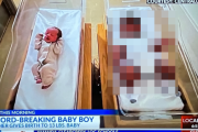 アメリカで約6000gの赤ちゃんが産まれる　かなりヤバい大きさなんだがｗｗｗｗｗ