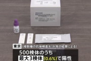 「抗体検査」東京の献血で０．６％陽性　検査キットごとに結果のばらつきあり
