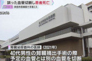 手術で誤った血管切断　40代の男性患者死亡「患者と遺族に深くお詫び」原因は医師の人為的ミス