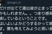 【悲報】骨延長の人、ついに切断か（画像あり）