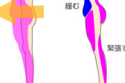 【前もも】立っているだけで張っているのが分かる。細くするのに効果的なこととは？