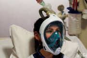 EUの医者「もしかしてシュノーケルマスクって酸素マスクに使えるんじゃね？」