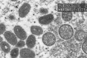 サル痘感染者、世界29か国で1000人超