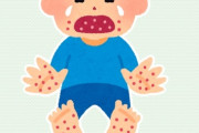 【流行病】34歳ワイ、手足口病に感染して地獄