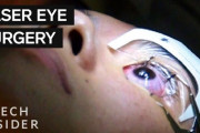 「絶対ムリ！」目のレーザー治療に耐えられる？ 海外の反応