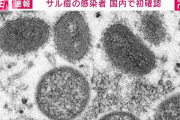 【悲報】サル痘で入院した患者の症状、怖すぎる
