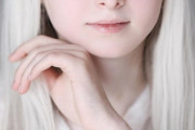 【画像】アルビノとオッドアイを併せ持って生まれた美少女がコチラ・・・・