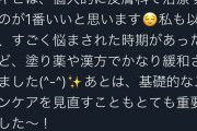 【朗報】声優の小倉唯さん、ニキビオタクに優しいアドバイスｗｗｗ