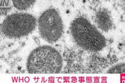 WHO「サル痘？緊急事態じゃねぇよw」1ヶ月後…WHO「サル痘緊急事態宣言」