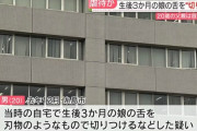 生後3か月の娘の舌を刃物のような物で切った疑いで20歳の父親を逮捕
