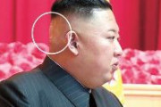 【速報】金正恩、頭の手術をしたか　後頭部に「バンド」を貼った写真が流出！