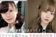【画像】総額1350万円の整形アイドルさん、めちゃくちゃ可愛くなるwwwwwwwwwwww