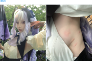 【画像】コスプレイヤーさん、とんでもない場所を蚊に刺されてしまうｗｗｗｗ
