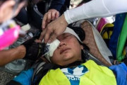 【香港デモ】「撃たないで！私達はジャーナリストだ！」警察が発射したゴム弾で外国人記者が右目失明