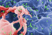 【ヤバイ】ロシアの主要なウイルス研究所が爆発　HIV、エボラ、炭疽菌、天然痘など貯蔵