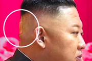 【悲報】金正恩の後頭部に貼り薬をはがした痕跡