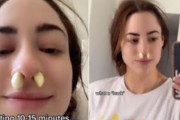 「鼻にニンニクを詰めると鼻づまりが解消」TikTokで広まった裏技に医師が警鐘