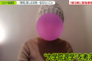 コロナ後遺症で髪が抜け落ちた女子大生が取材に応じる「退学も考えている、もう就職もできない…」