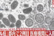 【速報】サル痘、都内で2例目が確認される