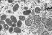 【速報】日本国内初の『サル痘』の感染者を確認。感染者は東京都内