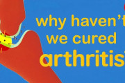どうして「人の関節痛を治す手段」って、いまだにないの？ 海外の反応