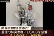 “人工の肺”装着でコロナ重症患者が回復へ、これを回復といっていいのか・・・？