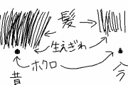 俺「父親の髪の毛フッサフサ！！祖父もフッサフサ！！曾祖父もフッサフサ！！親戚全員フッサフサ！！俺だけ前髪スッカスカ！！」