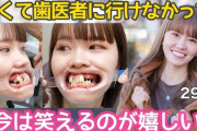女性さん、歯列矯正でとんでもない美人になってしまう