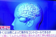 【画像】てんかん、脳みそが前後逆になるクッソ恐ろしい病だった