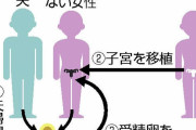 子宮移植、臨床研究を容認へ…「自発的」「無償提供」など条件に