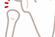 肩甲骨はがしとかいう整体