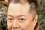 【超画像】ブラマヨ小杉さん、ハゲ上がる寸前だと話題にwwwwww