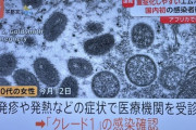 【速報】「サル痘」、日本上陸ｗｗｗｗｗ