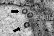 【韓国】新型コロナウイルスを分離　韓国の研究チームが電子顕微鏡写真