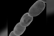 【前代未聞】全長〇cmのあり得ないサイズの細菌が発見される・・・「人間に例えると〇〇のようなもの」