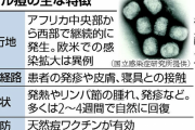 【悲報】サル痘感染者男性、7月中旬に帰国したものの25日まで受診せず