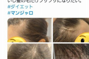 糖尿病治療薬のマンジャロを痩せるために飲んでた美容界隈、軒並みハゲ始めてしまう