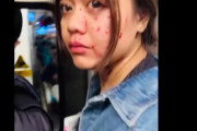 【悲報】列車に投石事件、女性の顔面を傷だらけにしてしまう…