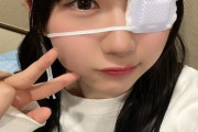 【日向坂46】眼帯が世界一似合うアイドル