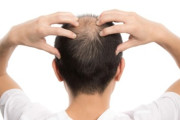【ハゲ】「薄毛が気になり出した年齢」　男性「38.6歳」　お前ら何歳からハゲだした？